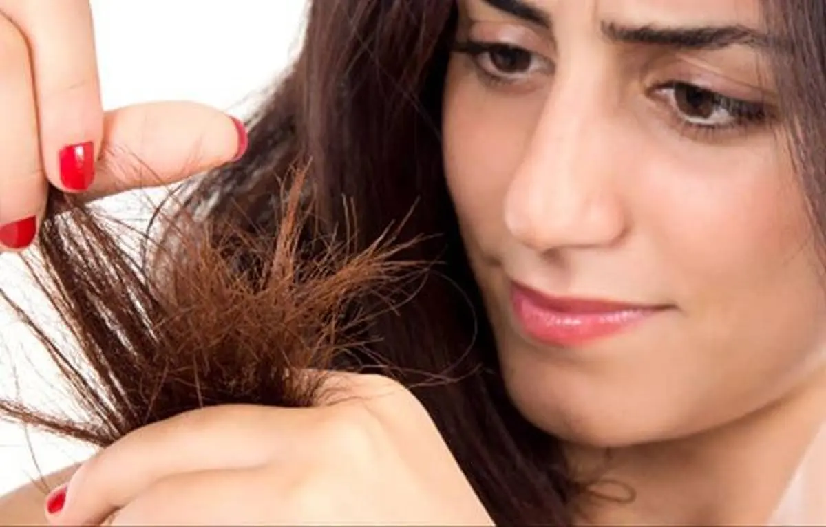 چرا موهایمان موخوره می گیرد؟ + راهکارهایی برای پیشگیری و درمان