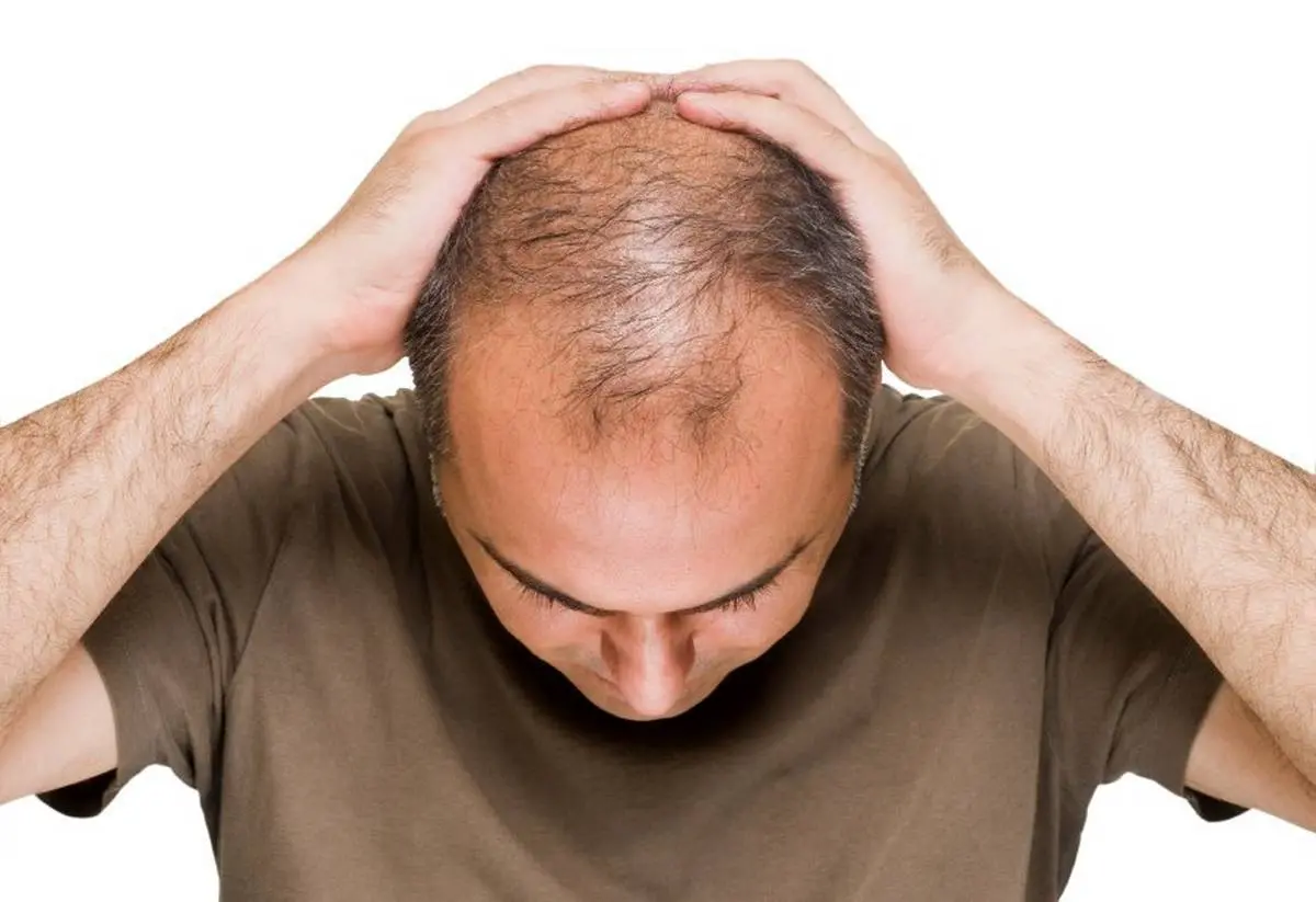 بهترین روش های رشد مو و جلوگیری از ریزش مو