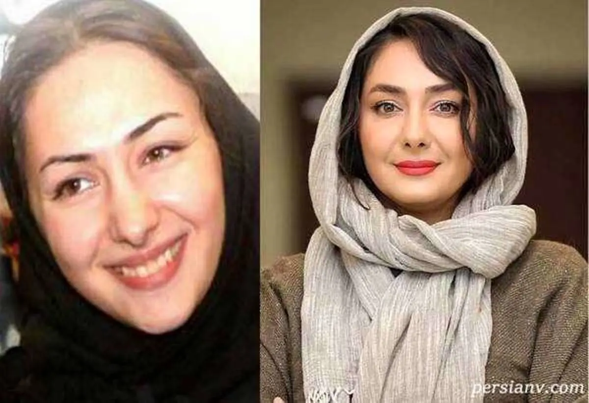 چهره هانیه توسلی قبل و بعد از عمل زیبایی | بیوگرافی هانیه توسلی