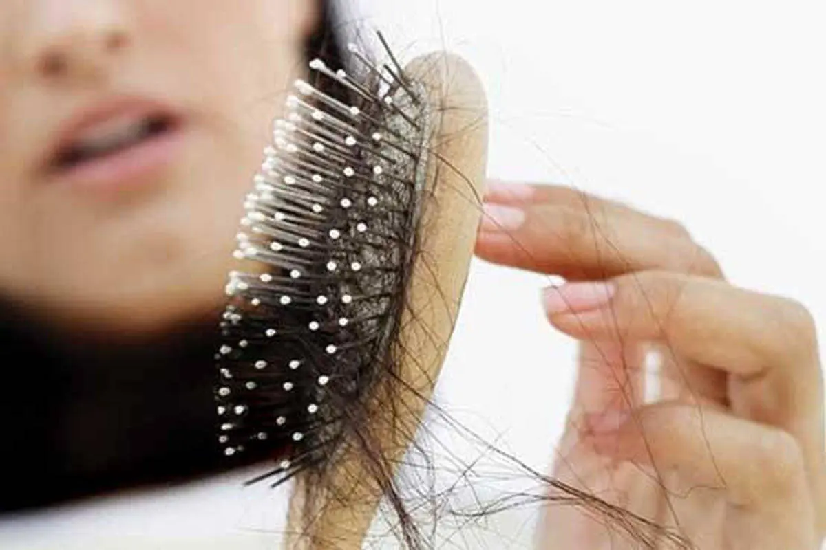 همه چیز دربارهٔ ریزش مو+ راه‌های جلوگیری و درمان