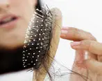 همه چیز دربارهٔ ریزش مو+ راه‌های جلوگیری و درمان