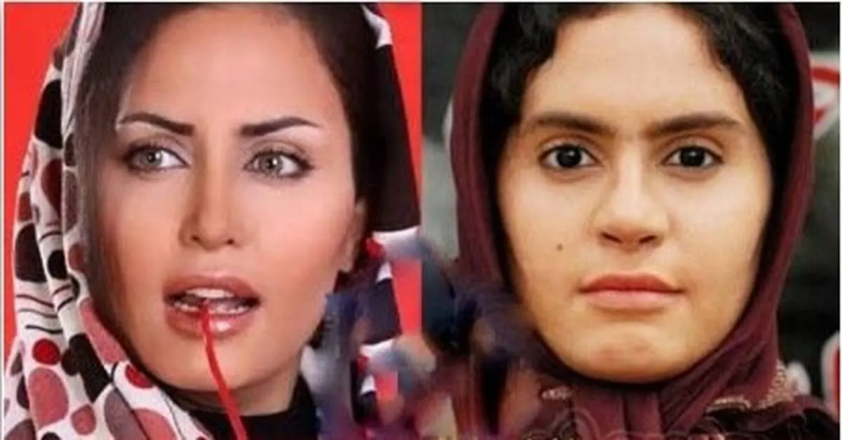 بازیگران زن ایرانی که با عمل زیبایی تغییر زیادی کردند + عکس