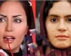 بازیگران زن ایرانی که با عمل زیبایی تغییر زیادی کردند + عکس