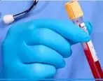 هر آنچه می‌بایست در رابطه با گلبول‌های سفید خون و آزمایشات WBC و Lymph بدانید!