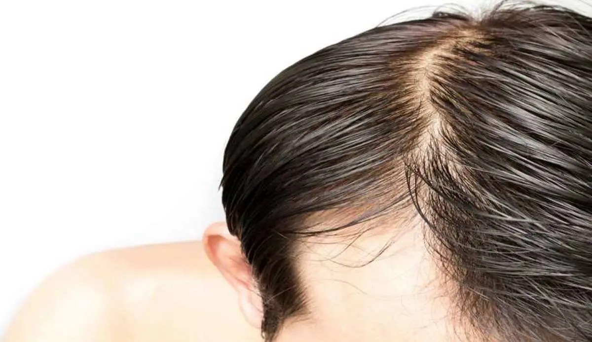 چرا موهایمان چرب می شود؟ + راه حلی برای کاهش چربی موها