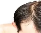چرا موهایمان چرب می شود؟ + راه حلی برای کاهش چربی موها