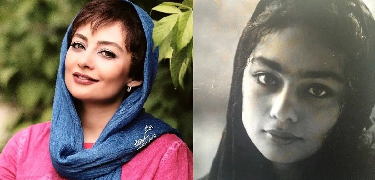 عکس غیرباور یکتا ناصر قبل و بعد عمل زیبایی  | تغییر 180 یکتا ناصر بعد عمل زیبایی 