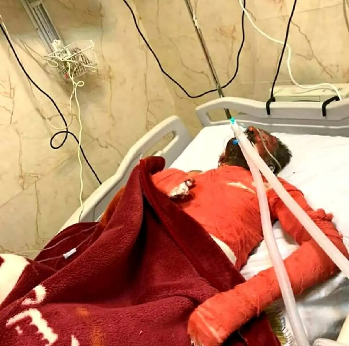 فرزند شهید یاسوجی که خودسوزی کرده بود درگذشت | علت خودسوزی روح‌الله برازیده + عکس