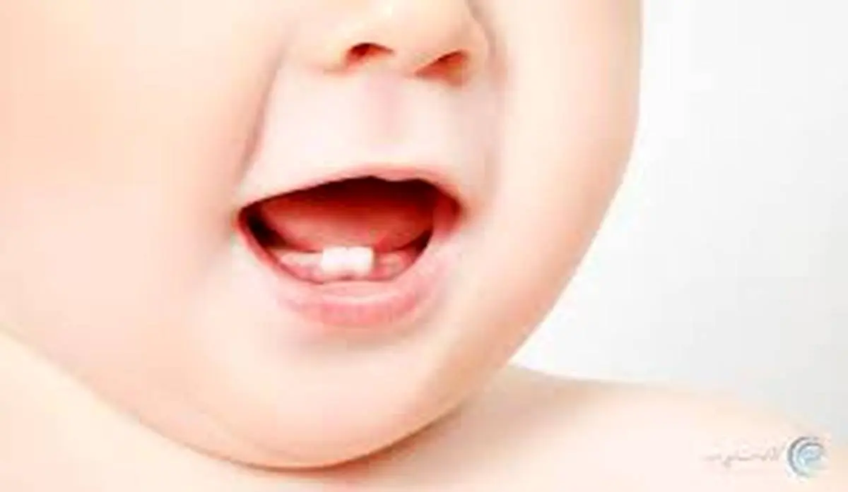  ژل دندان برای نوزادان مفید است یا مضر ؟ 