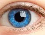  مثلث صورتی داخل چشم نشانه چه بیماری است؟