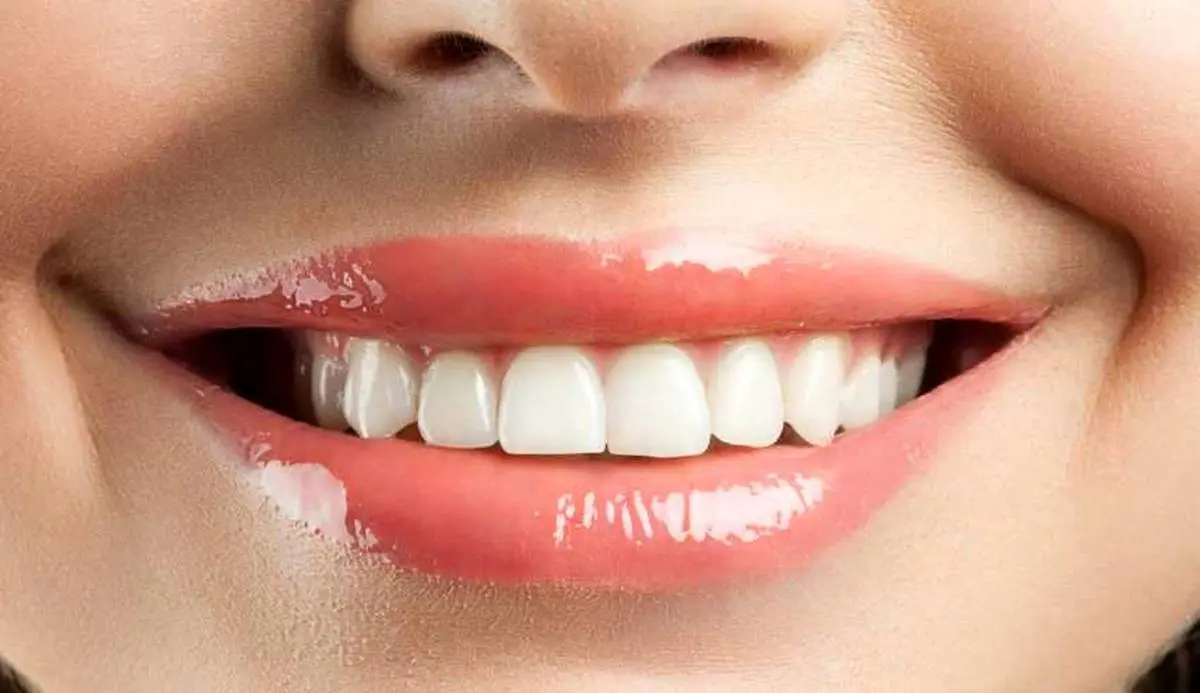 یک روش خاص و متفاوت برای سفید کردن دندان | با این روش دندانت همیشه برق میزنه