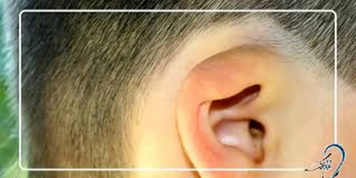 11 درمان راحت عفونت گوش در کودکان و بزرگسال