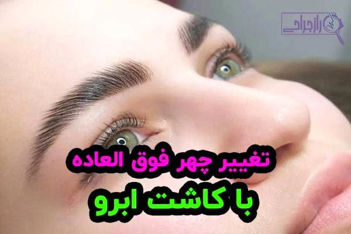 کاشت ابرو و مو فوق العاده زیبا در راز جراحی