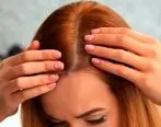 علت ریزش موی زنان در هر سنی چیست؟