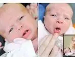 نوزادی که با یک دندان به دنیا آمد! + عکس