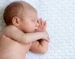 درمان خانگی عرق سوز شدن نوزاد