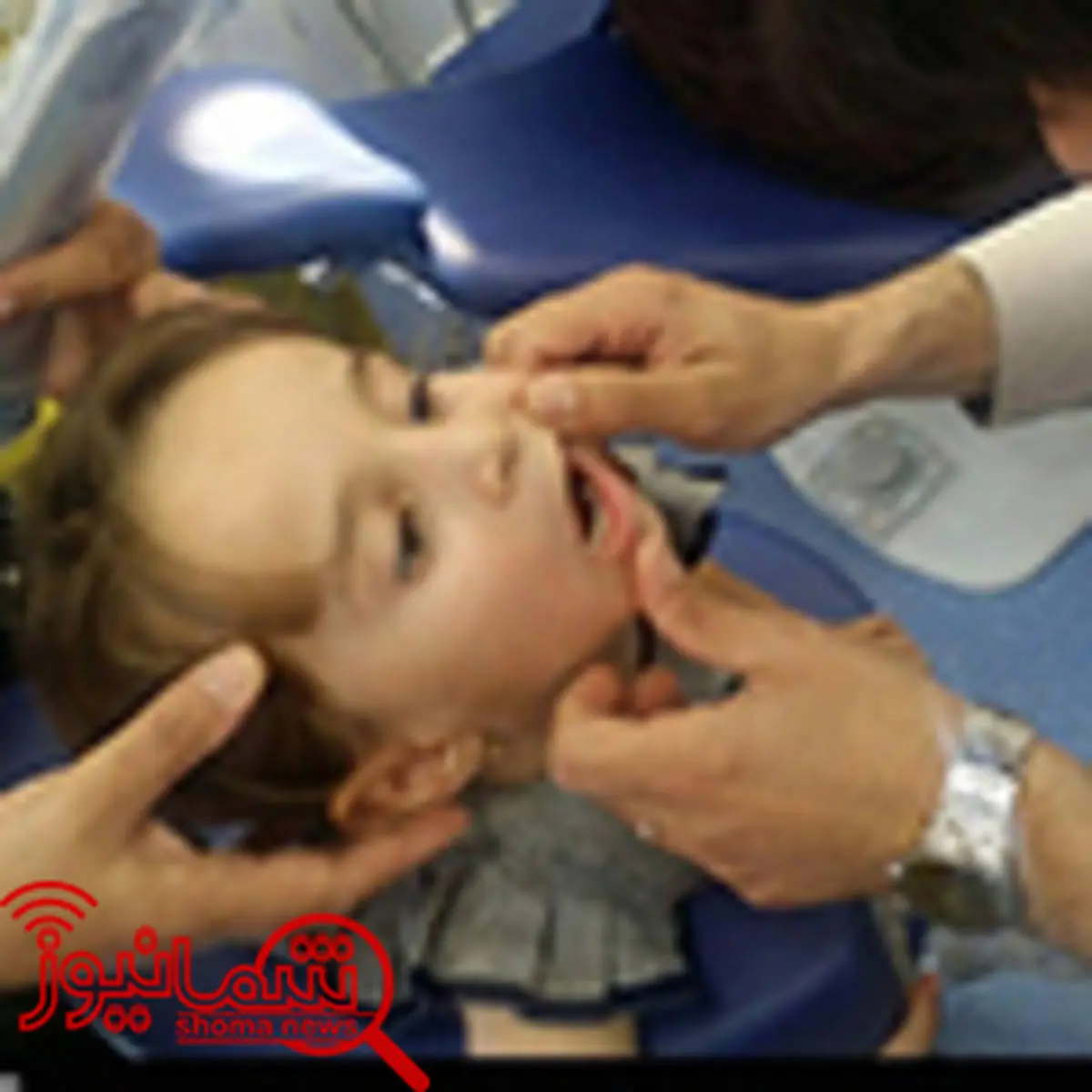 دلایل اصلی پوسیدگی دندان‌ کودکان