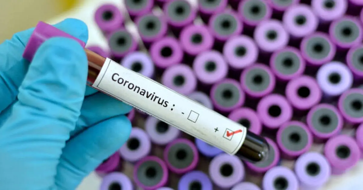 نتیجه نهایی آزمایش دو مورد مرگ بیمار مشکوک به کروناویروس